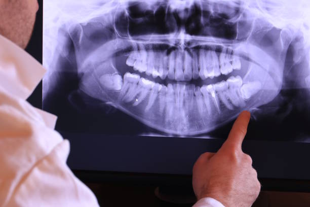 Best Emergency Dental Care for Broken or Chipped Teeth in Hillandale, MD
